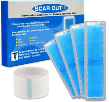 Silicone-Scar-Sheets-for-Scar-Removal